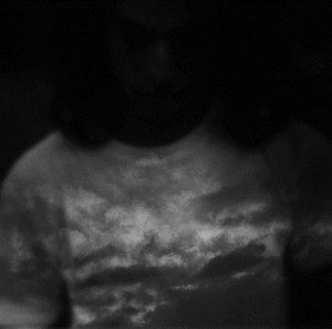 The clearest photo ever taken of EUS!